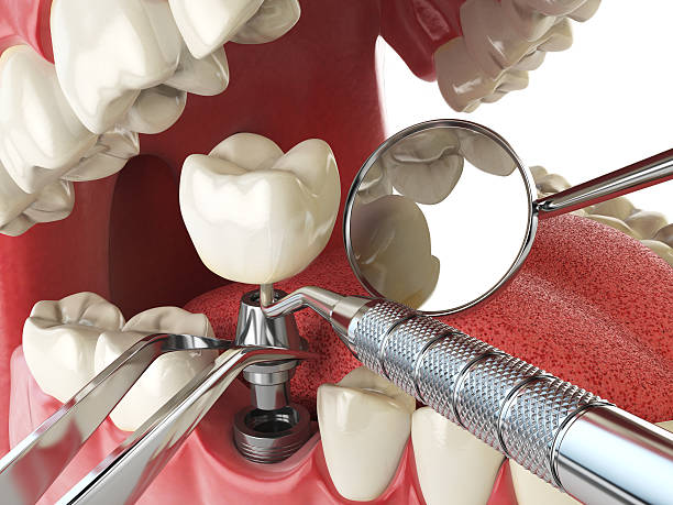 Best Emergency Cosmetic Dentistry in Ingram, TX